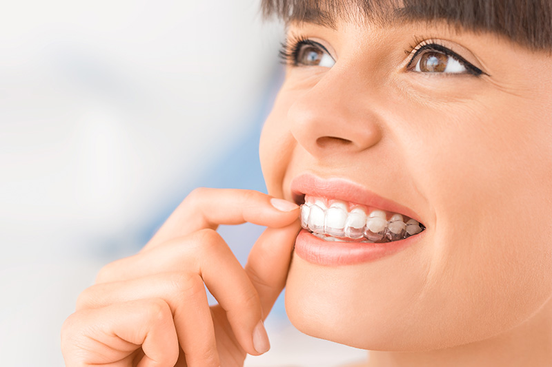 Invisalign in Plaistow