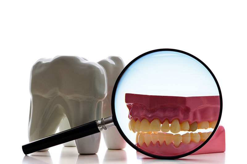 Root Canal in Plaistow